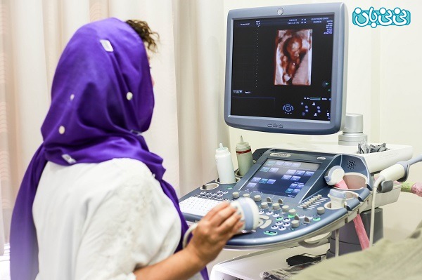 احتمال اشتباه در سونوگرافی تعیین جنسیت